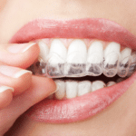 invisalign park slope ny