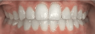 Best Orthodontist In Prospect Heights Ny