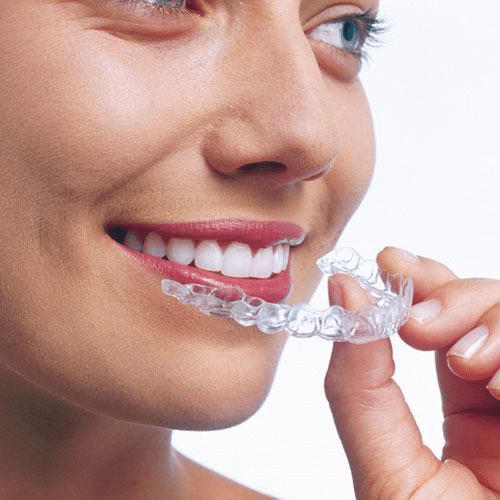 Invisalign Cost  Scantlebury Orthodontics