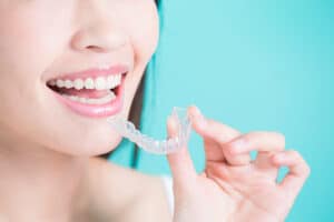 Foods To Avoid With Invisalign
