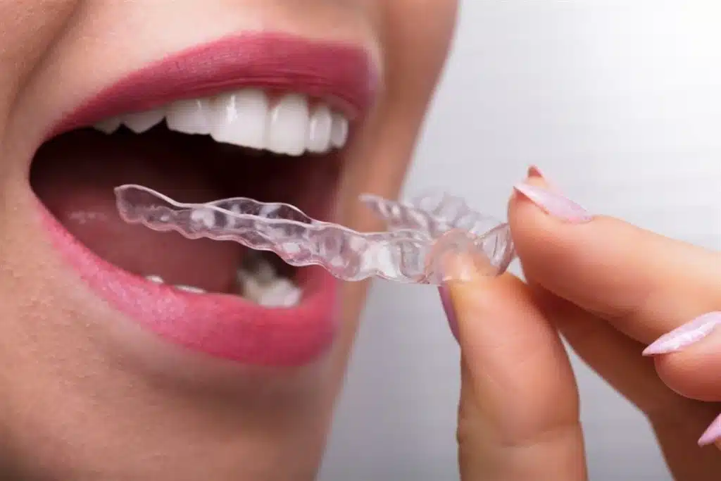 Adult Orthodontics Plans: Effective Treatments For All Ages