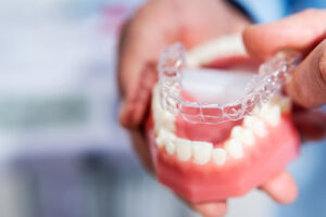 Invisalign Journey: The Ultimate Guide to a Perfect Smile
