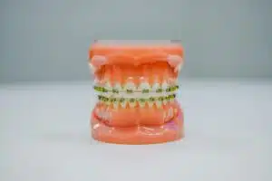 Braces Pregnancy: Crucial Safety Tips For Orthodontic Care