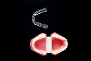 Braces vs Invisalign: