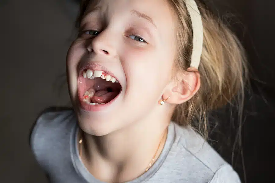 Children Braces Guide: Powerful Ways Early Treatment Helps Growth