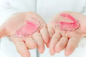 Types Of Retainers Available In Clinton Hill