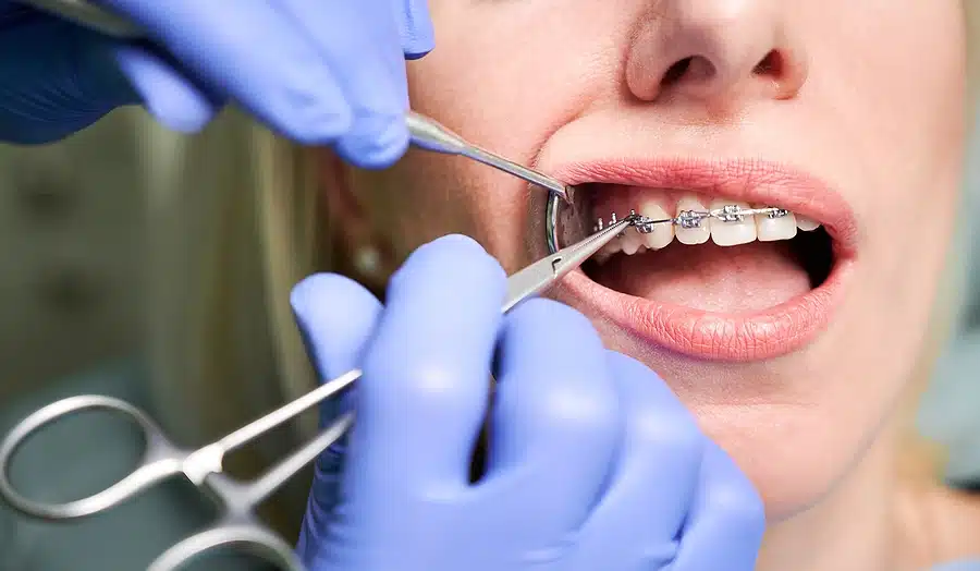 Orthodontist near Crown Heights NY helping a patient with braces